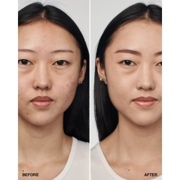 Clinique Even Better Clinical Serum Foundation SPF 20 machiaj de îngrijire SPF 20