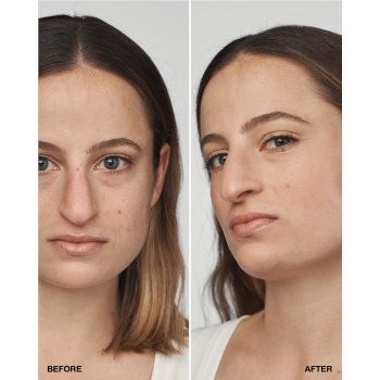 Clinique Even Better Clinical Serum Foundation SPF 20 machiaj de îngrijire SPF 20