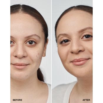 Clinique Even Better Clinical Serum Foundation SPF 20 machiaj de îngrijire SPF 20