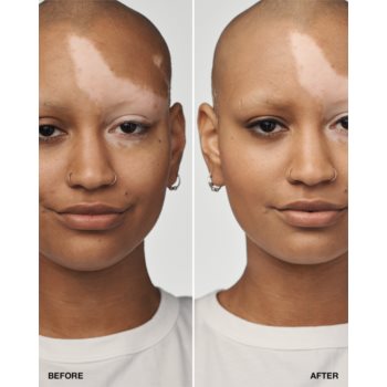 Clinique Even Better Clinical Serum Foundation SPF 20 machiaj de îngrijire SPF 20