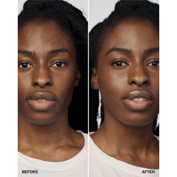 Clinique Even Better Clinical Serum Foundation SPF 20 machiaj de îngrijire SPF 20
