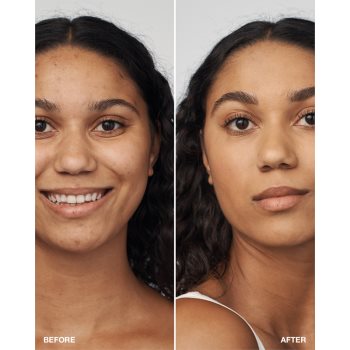 Clinique Even Better Clinical Serum Foundation SPF 20 machiaj de îngrijire SPF 20