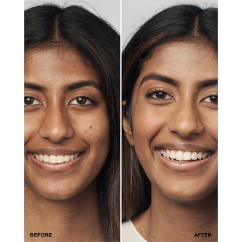 Clinique Even Better Clinical Serum Foundation SPF 20 machiaj de îngrijire SPF 20