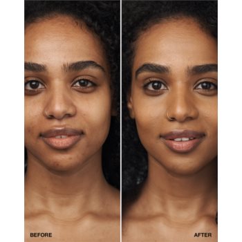 Clinique Even Better Clinical Serum Foundation SPF 20 machiaj de îngrijire SPF 20