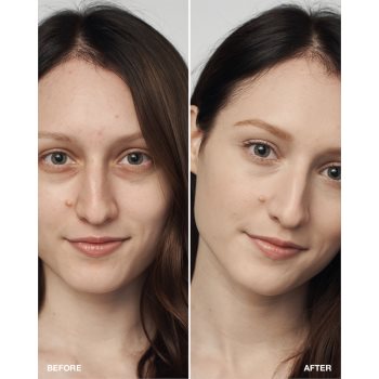 Clinique Even Better Clinical Serum Foundation SPF 20 machiaj de îngrijire SPF 20