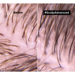L’Oréal Professionnel Serie Expert Scalp Advanced șampon și mască 2 în 1 pentru par si scalp gras