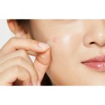 Cosrx Clear Fit Master Patch plasture de curatare pentru pielea problematica